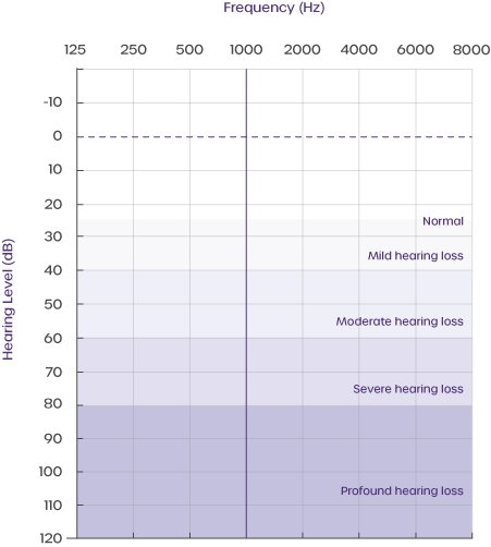 hearing-loss-categorisation