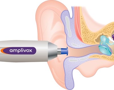 umbrella-tip---incorrect-size